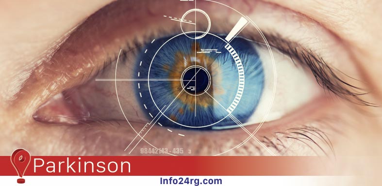 Parkinson