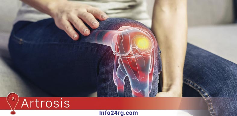 artrosis