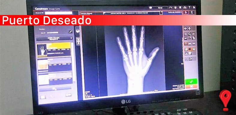 Ponen en marcha nuevo sistema de radiología digital