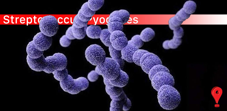 Streptococcus Pyogenes -Río Gallegos