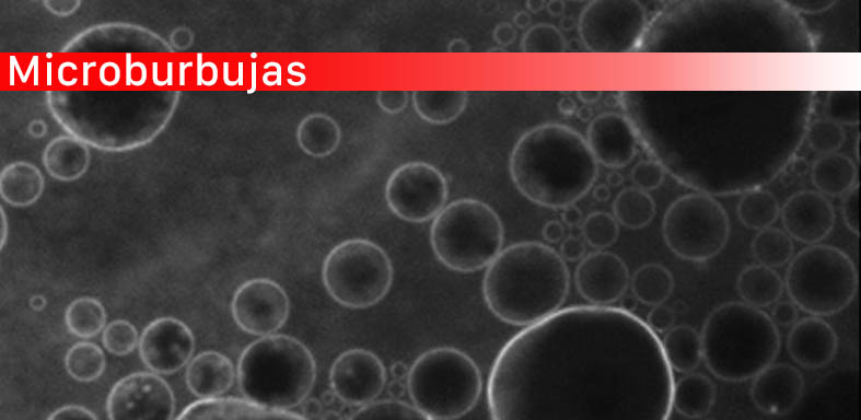 Microburbujas y ultrasonidos abren la barrera del cerebro para introducir fármacos